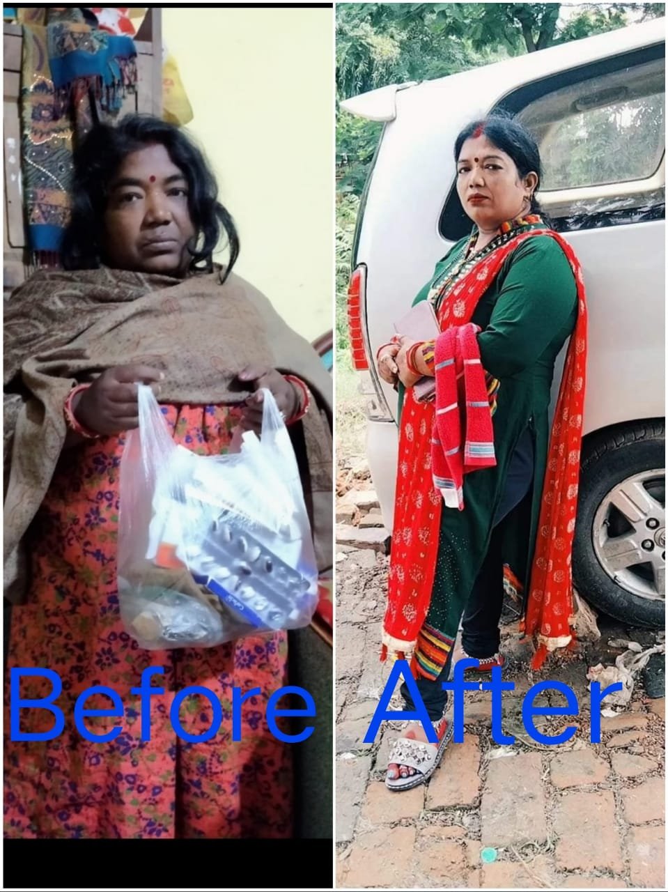 Ankita R. Transformation